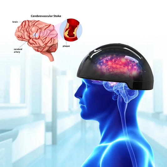 The Transformative Power of the 810nm Infrared Brain Wave Helmet: Revolutionizing Cognitive Wellness